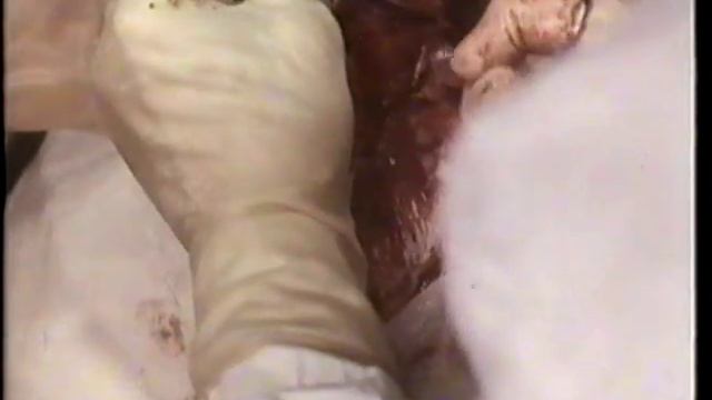 Кесарево сечение © Сesarian Section