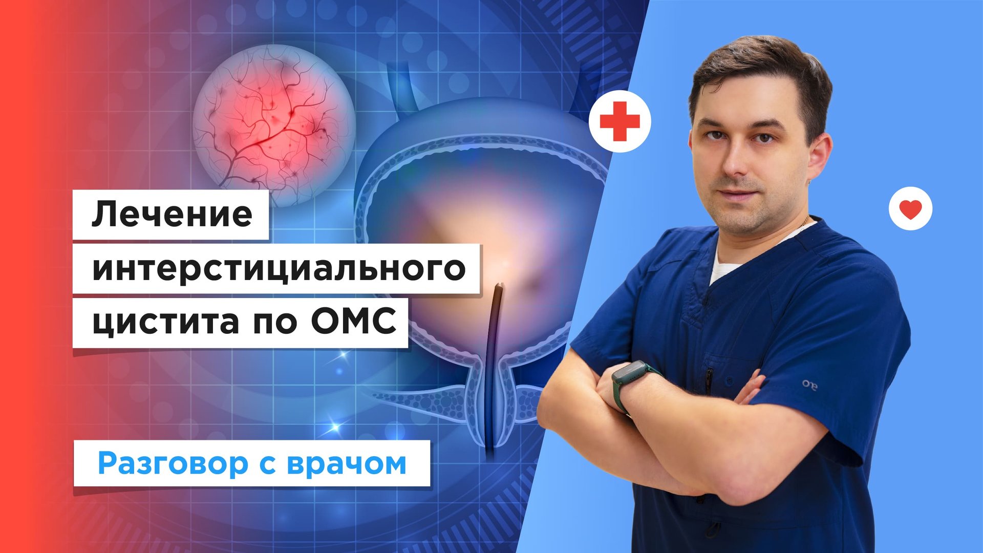 Лечение интерстициального цистита по полису ОМС смотреть онлайн