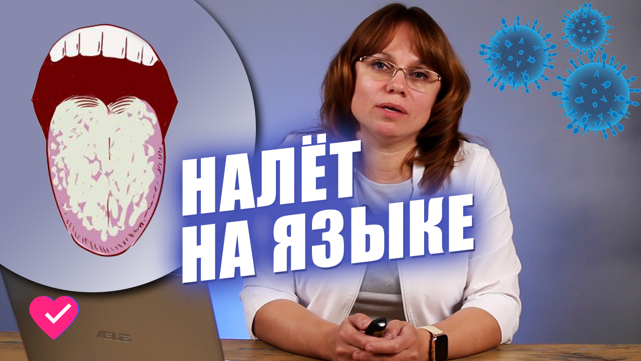 О ЧЁМ ГОВОРИТ НАЛЁТ И ЦВЕТ ЯЗЫКА