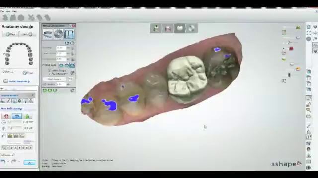 3Shape TRIOS Color Pod Digital Impression Scan Argen Canada смотреть онлайн