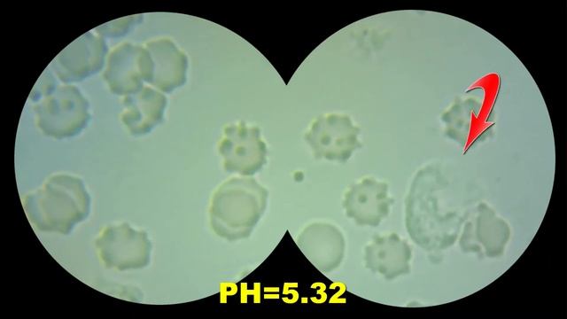 Какая кровь под микроскопом после хлеба (днем) и вина (вечером)? Гемосканирование. Кровь. смотреть онлайн