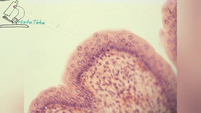 #многослойный переходный эпителий смотреть онлайн