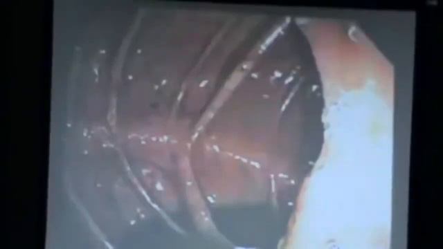 Доктор Ольга Бутакова, очищение организма. Зачем Коло Вада смотреть онлайн