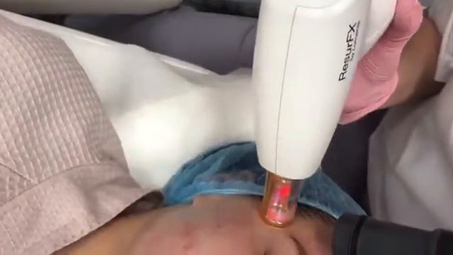 Фотоомоложение на лазерном аппарате М22 в Центре «Этика» смотреть онлайн