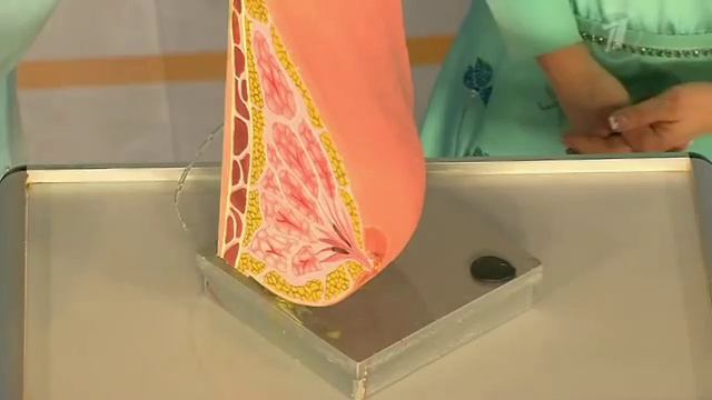 Эктазия молочных протоков. Чем опасна боль в груди смотреть онлайн