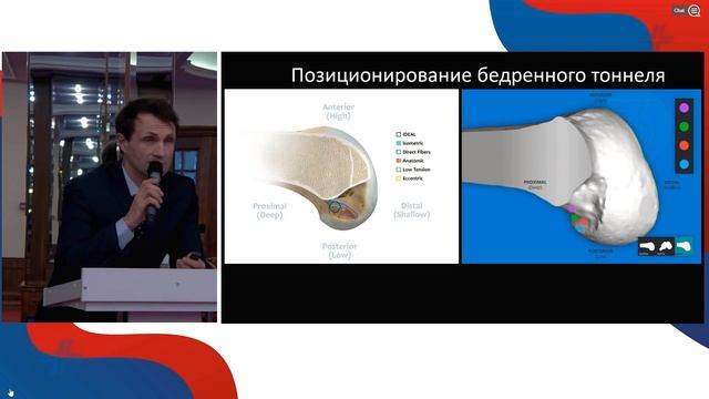 Принципы реконструкции ПКС у активных пациентов. "Приоровские чтения-2023". Доклад Миленина О.Н. смотреть онлайн