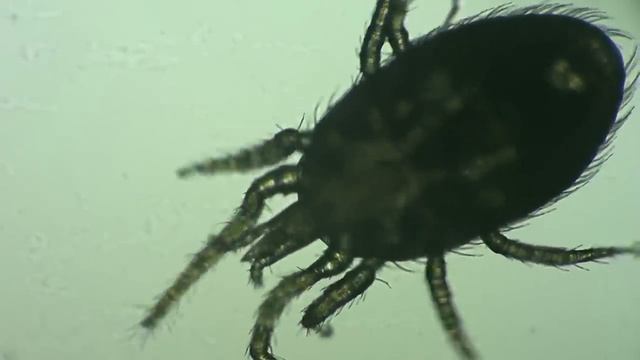 Dermatology. Dermatophagoides Pteronyssinus (House Dust Mite).