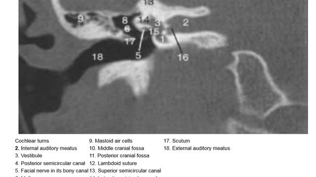 radiologic anatomy of the ear part 1 смотреть онлайн