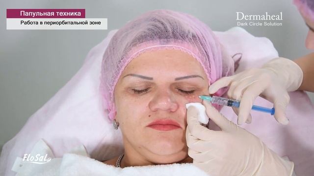 Online-каталог FloSal: мезококтейль от темных кругов Dermaheal Darck Circle. Техники введения. Фото