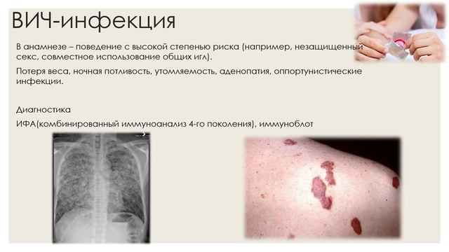 11. Инфекционная патология ч5.mp4 смотреть онлайн