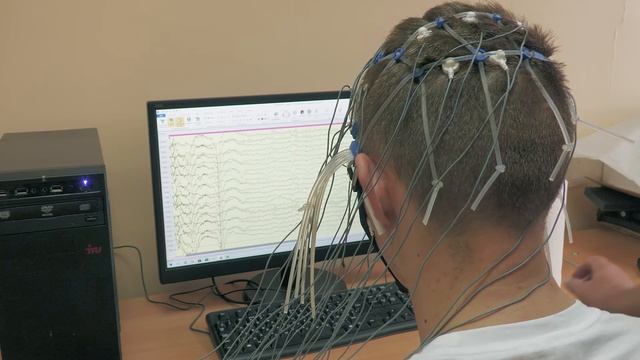 Электроэнцефалография. Как проводится ЭЭГ? Тест на эпилепсию и интересный эксперимент. смотреть онлайн