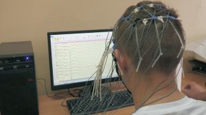 Электроэнцефалография. Как проводится ЭЭГ? Тест на эпилепсию и интересный эксперимент.