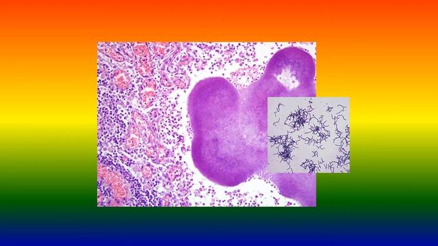 Actinomyces hordeovulneris смотреть онлайн