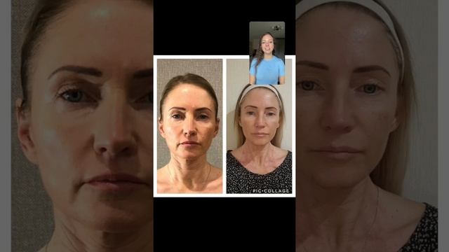 Здоровая и молодая шея - залог красоты лица смотреть онлайн