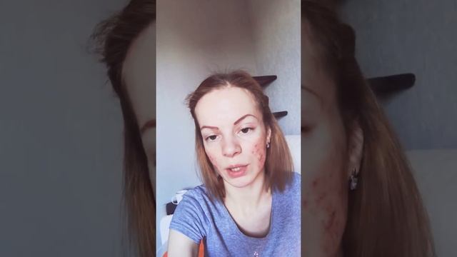 Гиалуроновый филлер смотреть онлайн