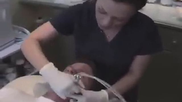 Microdermabrasion смотреть онлайн