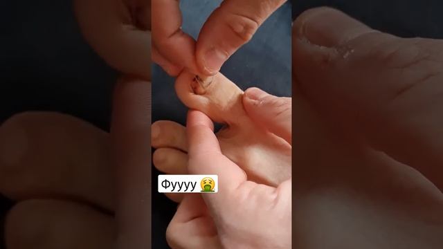 фуууу, ОТОРВАЛ ноготь с КОРНЕМ. СЛАБОНЕРВНЫМ НЕ СМОТРЕТЬ смотреть онлайн