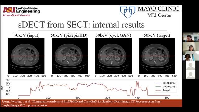 MedAI Session 30: GANs in Medical Image Synthesis, Translation, and Augmentation | Jason Jeong смотреть онлайн