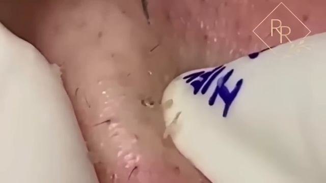 Ouça o seu coração #SN0 смотреть онлайн