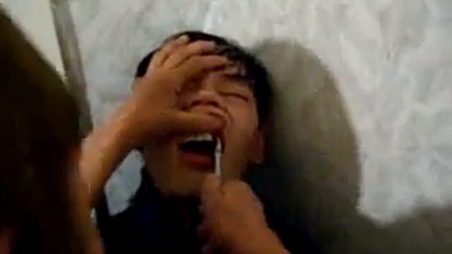 саха удаления зуба