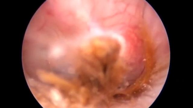 Правое ухо Долгов смотреть онлайн