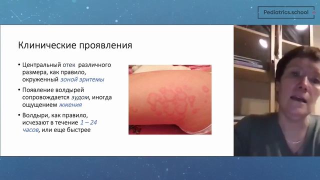 Крапивница, ангиоотек по материалам отечественных и международных согласительных документов смотреть онлайн