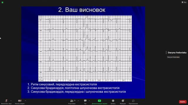 Розбір ЕКГ від курсантів 2022 10 27 10 01 24 смотреть онлайн