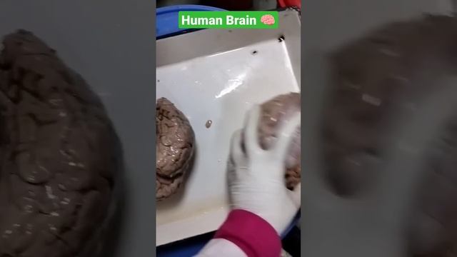 Human Brain ??#Mbbs?#Shkmgmc ?#Human#Brain??#Anatomy??#Dissectionhall❤️ смотреть онлайн