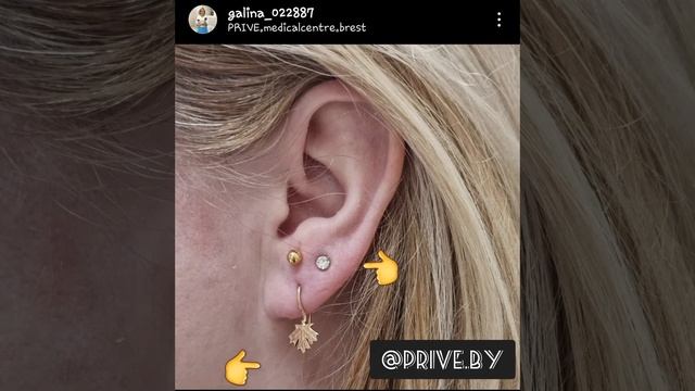 когда одной мало#серьги #мояработа#медицина #ушки смотреть онлайн
