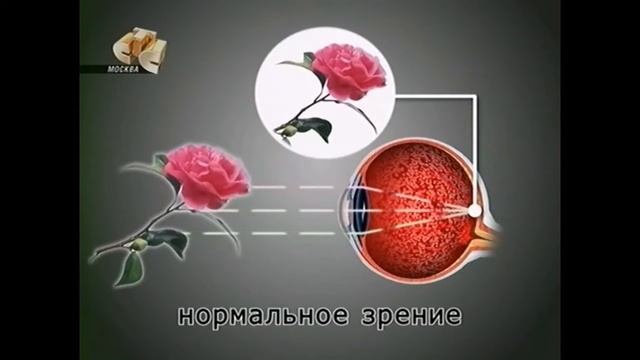 Все про зрение как подбирают очки смотреть онлайн