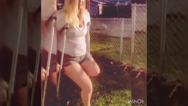 Encaixe novo passando na sua timeline #amputee #amputada #prosthetic #crutches #amputiert