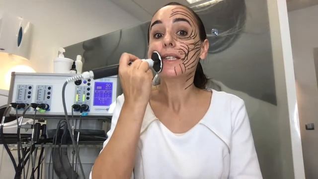 CÓMO HACER UN TRATAMIENTO de Radiofrecuencia смотреть онлайн