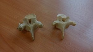 Оси и плоскости тела человека. Анатомическая терминология. Скелет туловища.