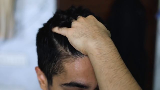 Top 5 Winter Hair Care Tips For Men | Men's Hair Care Routine | BeerBiceps Grooming