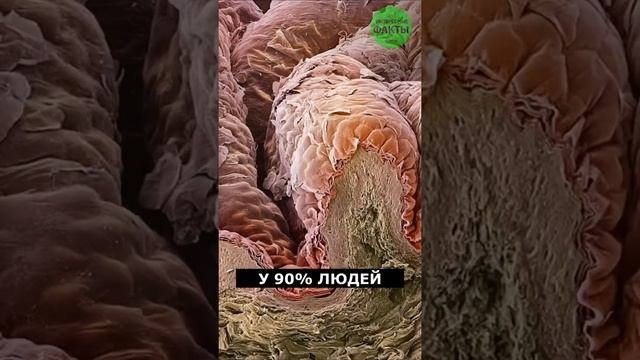 Кто живет у нас на лице?? Клещи? #факты смотреть онлайн