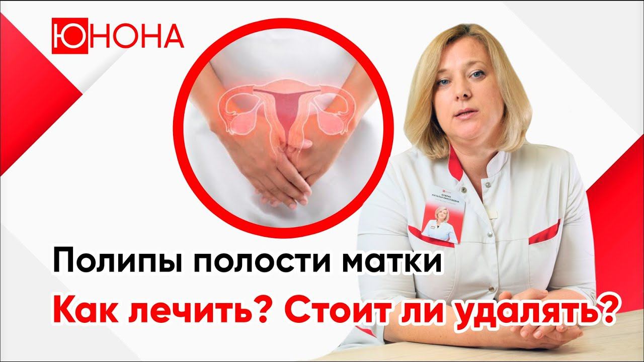 Полипы полости матки. Как лечить? Стоит ли удалять полипы? смотреть онлайн