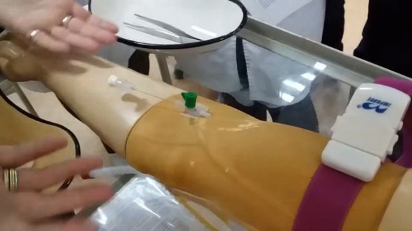 кубитальный катетер