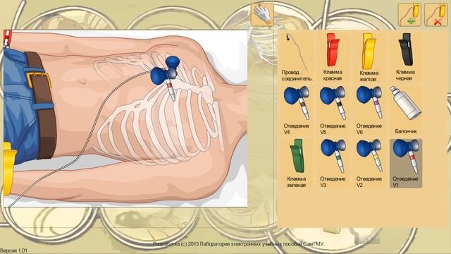 Установка электрокардиографа и настройка показателей смотреть онлайн