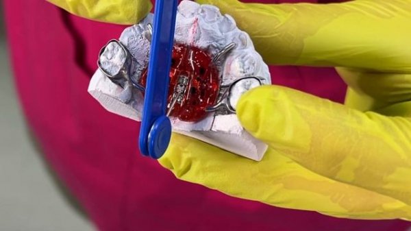 КАК ПОЛЬЗОВАТЬСЯ АППАРАТОМ - ПЛАСТИНКОЙ МАРКО РОСА ?