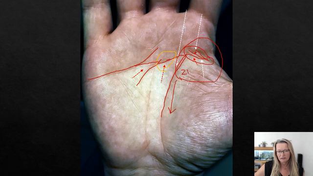 Island at start of life line and weak head line meaning, example palm reading смотреть онлайн
