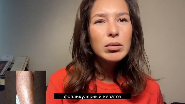 СУХАЯ КОЖА? ИСКЛЮЧИ ВСЕГО ОДИН ИНГРЕДИЕНТ смотреть онлайн