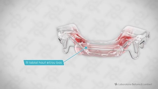Vue 360 de l’appareil dentaire Twin Block de Clark смотреть онлайн