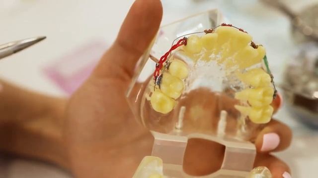 БРЕКЕТ ОТКЛЕИЛСЯ, КОЛИТ, НАТИРАЕТ ЧТО ДЕЛАТЬ смотреть онлайн