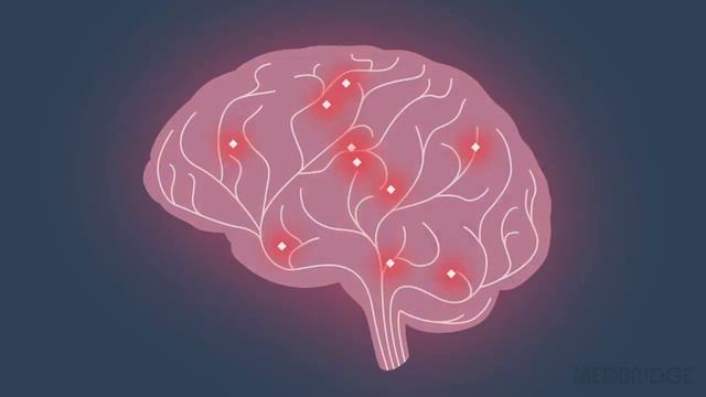 Mindfulness as a Technique for Calming the Brain - Susan Stralka | MedBridge смотреть онлайн