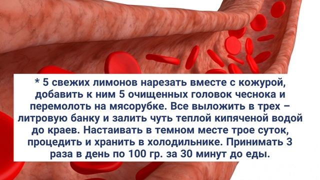 У бабушки в 72 года сосуды здоровее, чем в 30! Всего 2 чайные ложки в день! смотреть онлайн