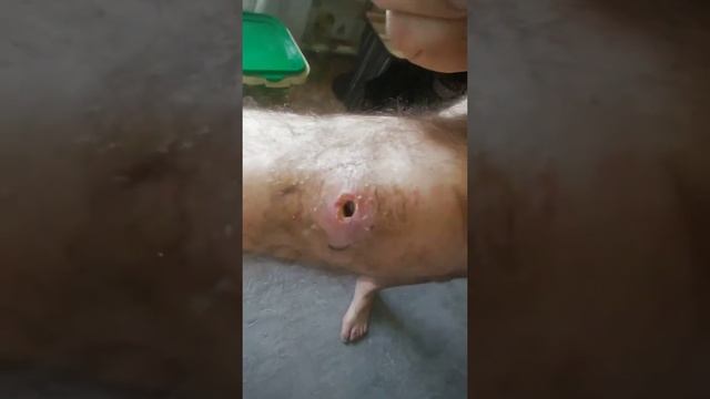 дыра в колене смотреть онлайн