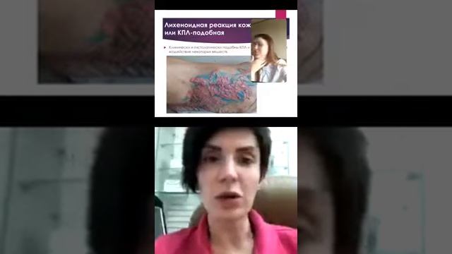 Реакции на татуировки. Эфир с врачом-дерматологом Константиновой Зоей Евгеньевной. смотреть онлайн