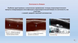 #УЗДГ-Актуальные вопросы практической допплерографии Елизарова Р.А.