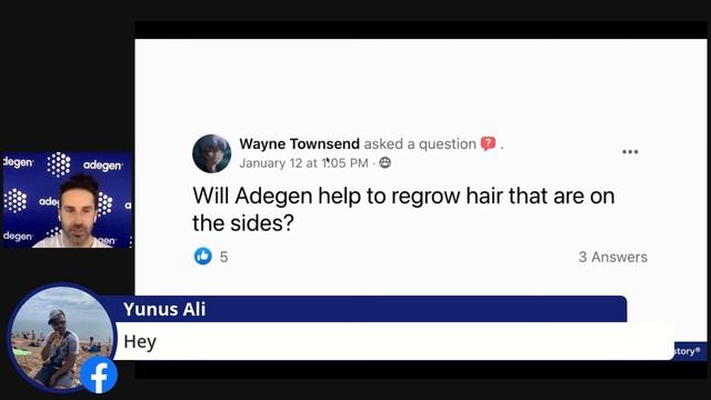 Can You Regrow Hair On Your Temples?