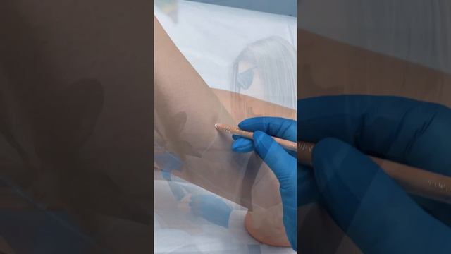 Лазерная эпиляция на аппарате CANDELA GentlemaxPro (США) “Natural Hair Clinic” смотреть онлайн